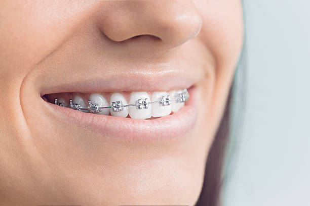 Full Mouth Reconstruction in Floris, VA